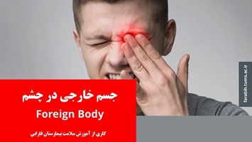 اقدامات اولیه در زمان ورود جسم خارجی به چشم